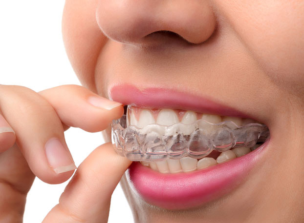 Orthodontics treatments