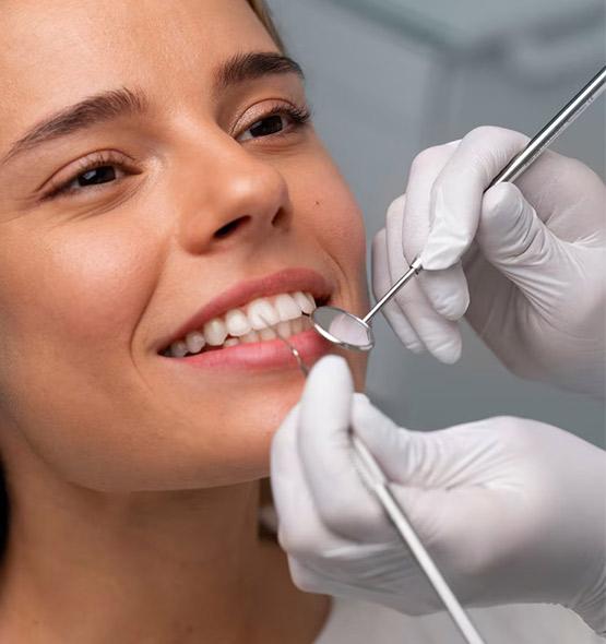 pre-treatment for non prep-facings